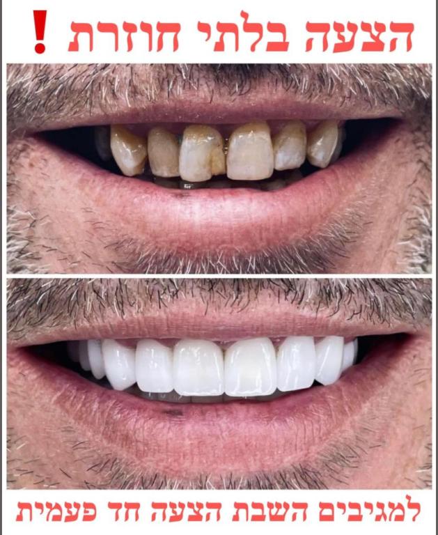 סמייל קליניק סמייל קליניק