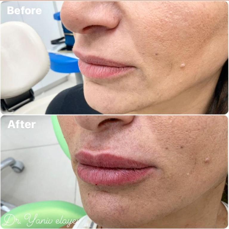 מרפאת שיניים ד"ר יניב מרפאת שיניים ד"ר יניב