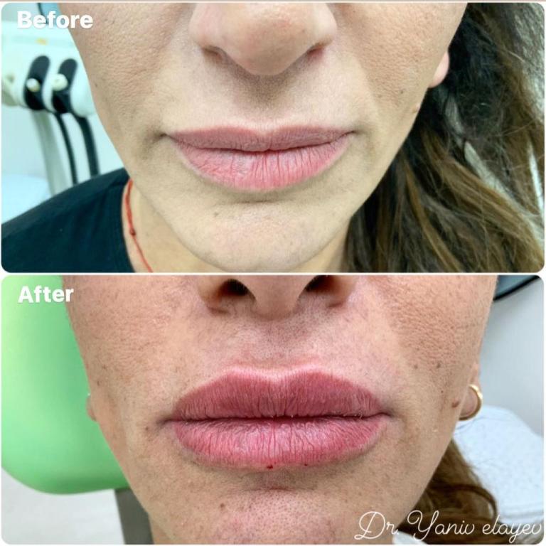 מרפאת שיניים ד"ר יניב מרפאת שיניים ד"ר יניב