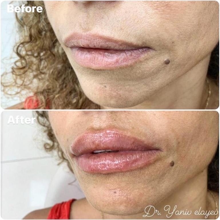 מרפאת שיניים ד"ר יניב מרפאת שיניים ד"ר יניב