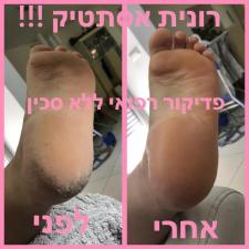 רונית אסתטיק שרות עד הבית