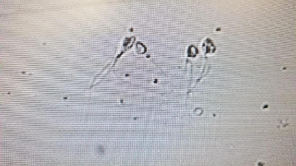 המרכז הארצי לפריון תדהר המרכז הארצי לפריון תדהר