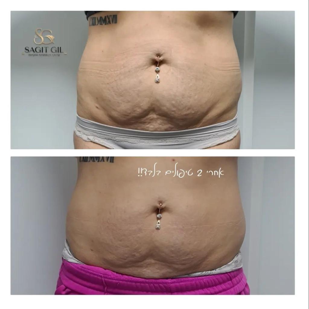 שגית גיל קוסמטיקאית שגית גיל קוסמטיקאית