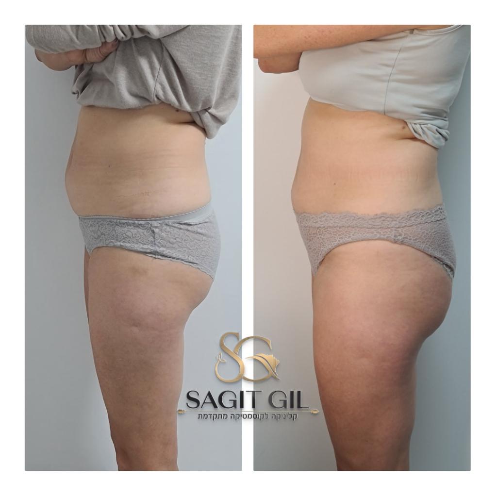 שגית גיל קוסמטיקאית שגית גיל קוסמטיקאית