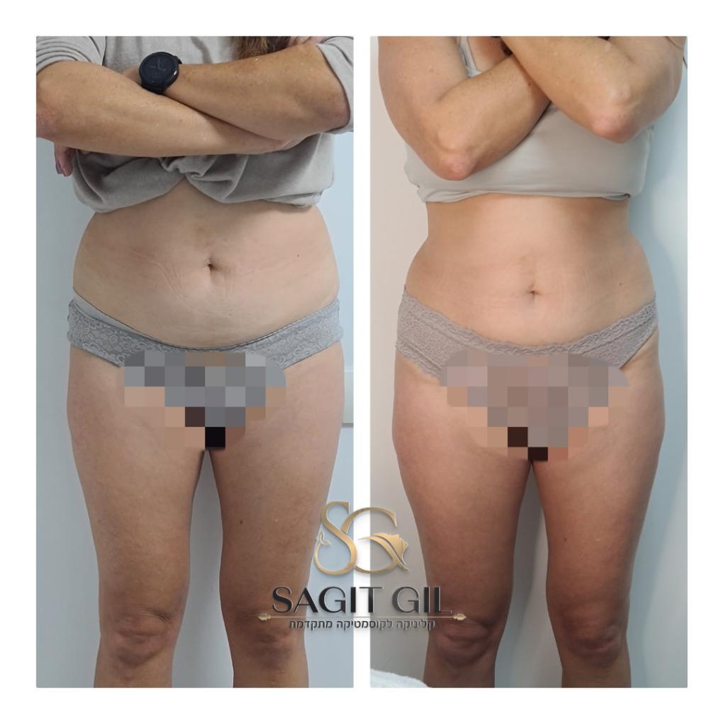 שגית גיל קוסמטיקאית שגית גיל קוסמטיקאית