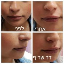 ביוטי סנטר רהט