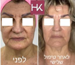 חגית כרם