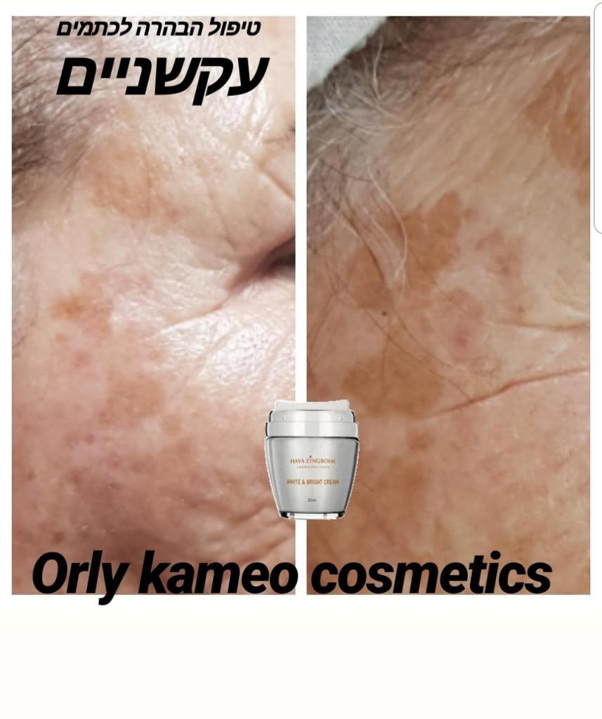 אורלי קמעו קוסמטיקאית אורלי קמעו קוסמטיקאית