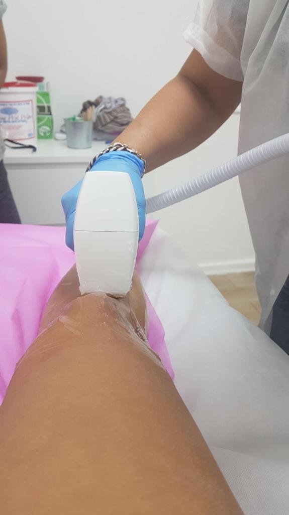 הום לייזר הום לייזר