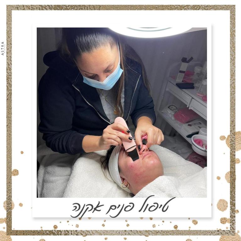 הום לייזר הום לייזר