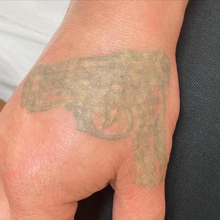 פארמה לייזר פארמה לייזר