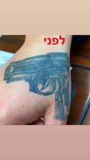 פארמה לייזר