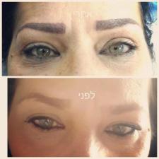 ענת קוסמטיק