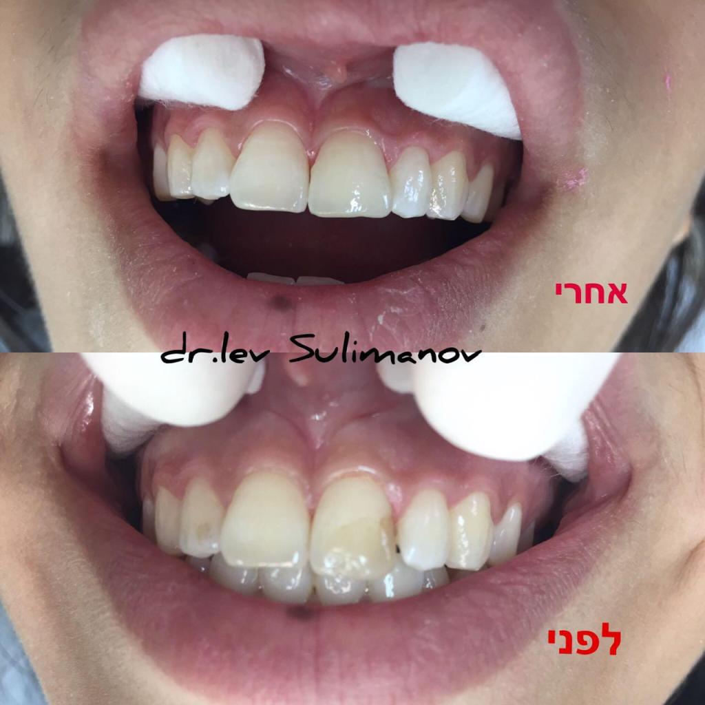 ד"ר לב ד"ר לב