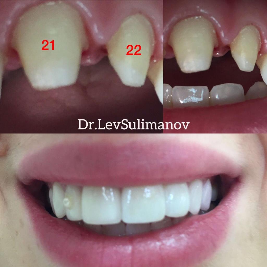 ד"ר לב ד"ר לב