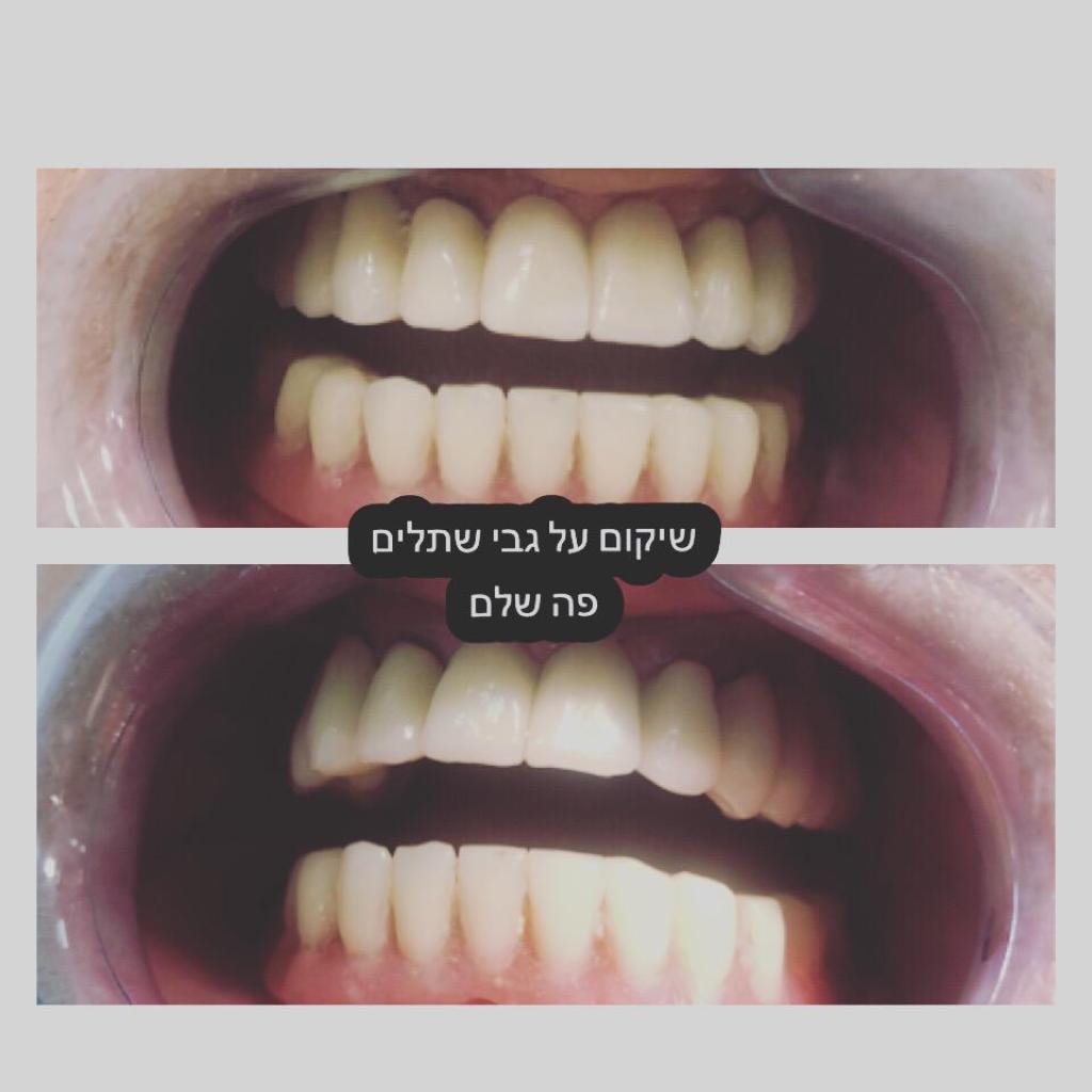 דר פידא עאזם דר פידא עאזם