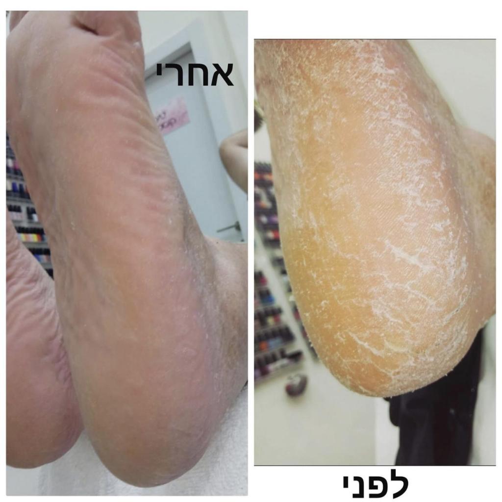 קליניק שרלי קליניק שרלי
