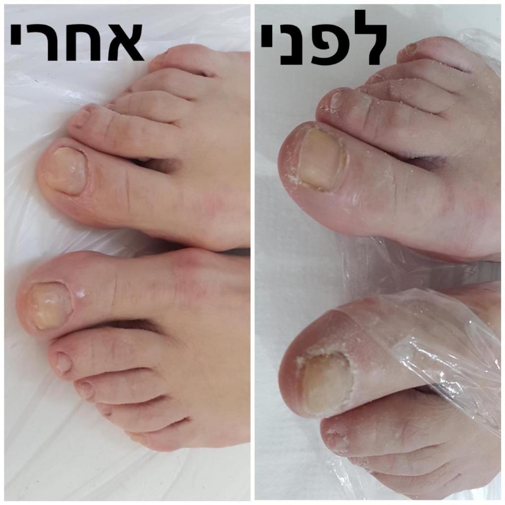 קליניק שרלי קליניק שרלי