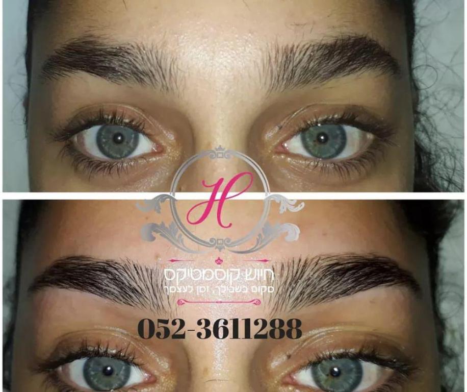 חיוש קוסמטיקס חיוש קוסמטיקס