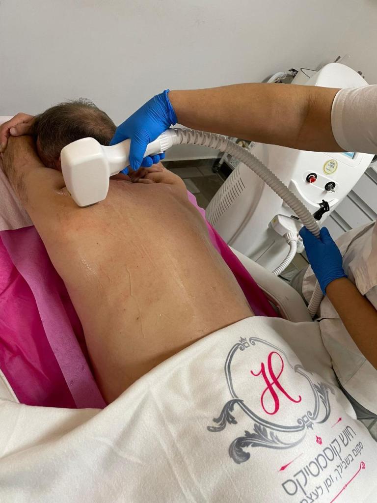 חיוש קוסמטיקס חיוש קוסמטיקס