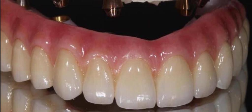 רוגדנט מעבדת שיניים רוגדנט מעבדת שיניים