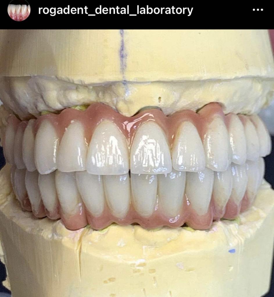 רוגדנט מעבדת שיניים רוגדנט מעבדת שיניים