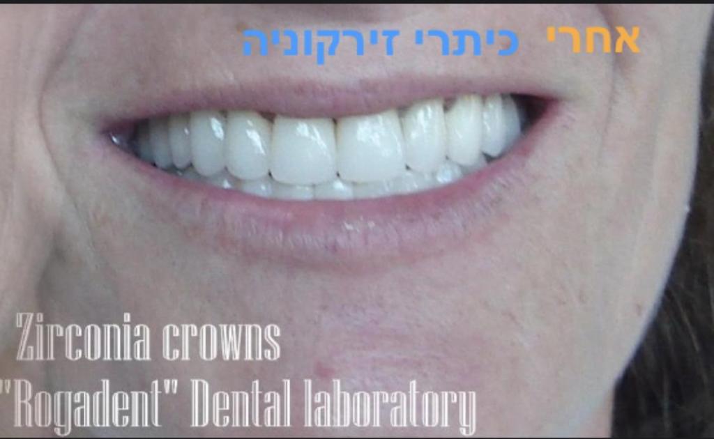 רוגדנט מעבדת שיניים רוגדנט מעבדת שיניים