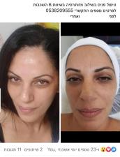 Iris cosmetics
