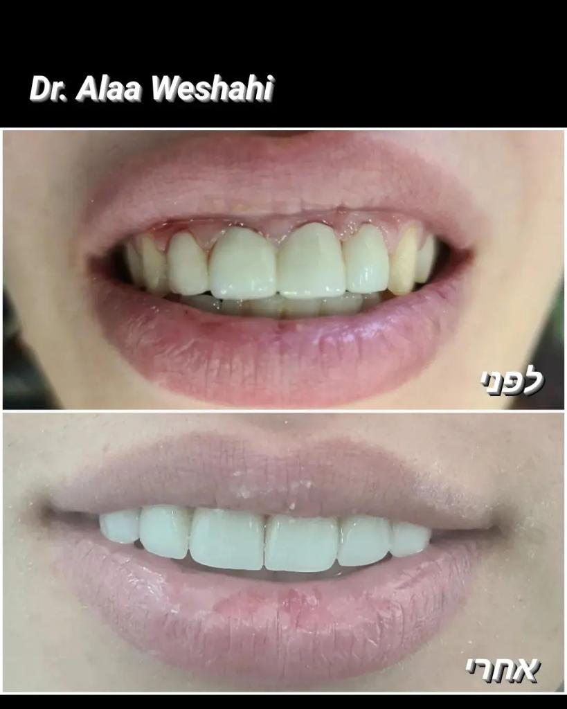 Evo Dent Clinic Evo Dent Clinic