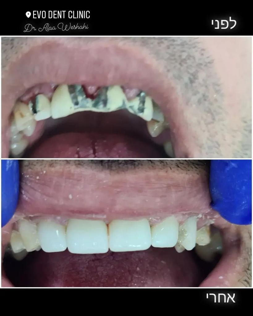 Evo Dent Clinic Evo Dent Clinic