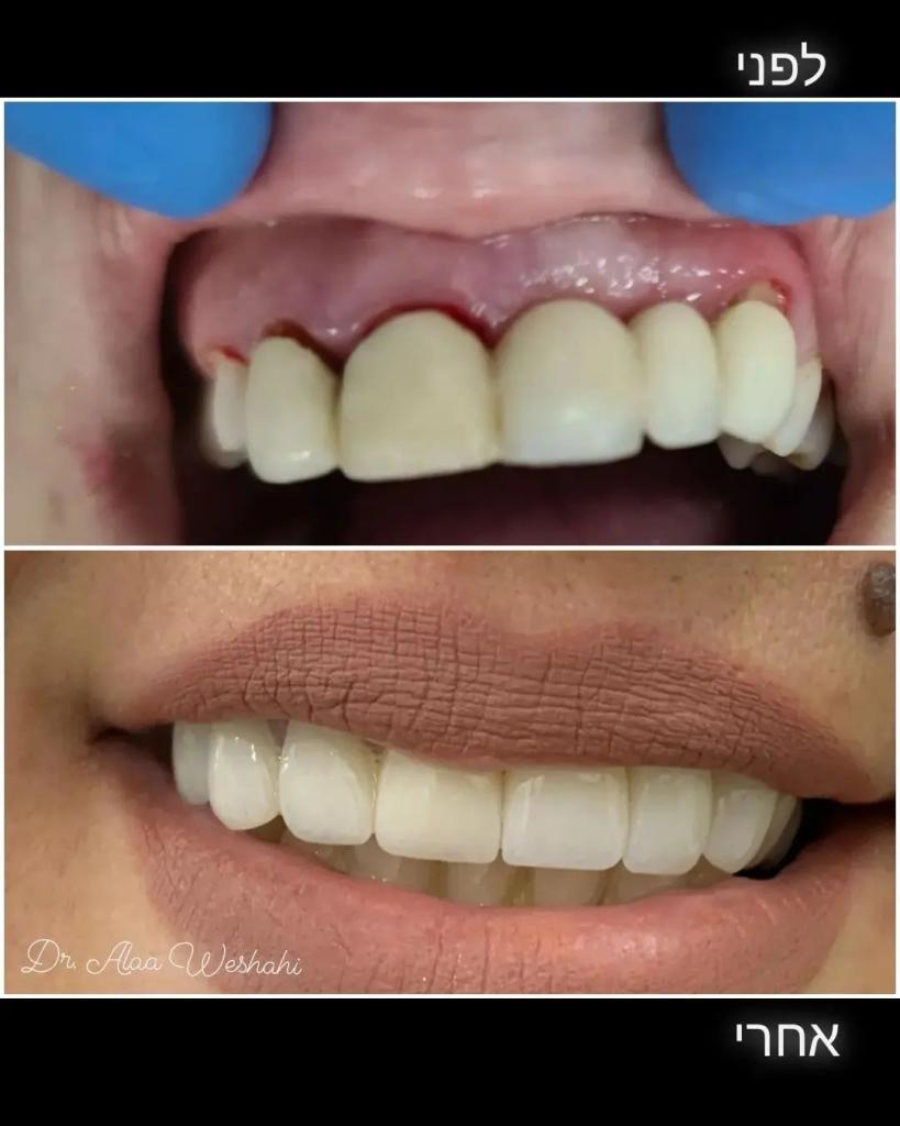 Evo Dent Clinic Evo Dent Clinic