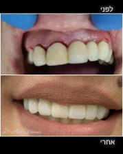 Evo Dent Clinic