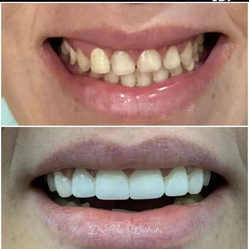 Evo Dent Clinic Evo Dent Clinic