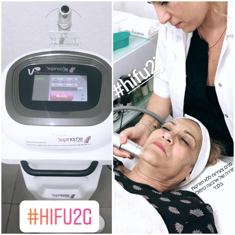 אושרית מגע של יופי אושרית מגע של יופי