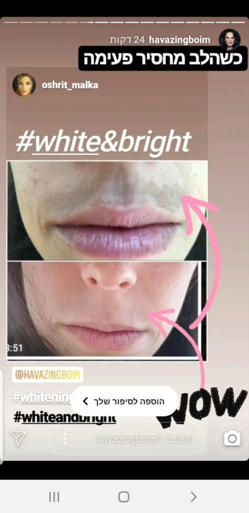 אושרית מגע של יופי אושרית מגע של יופי