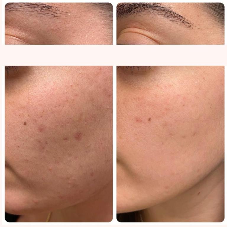 שלומית שטרקמן שלומית שטרקמן