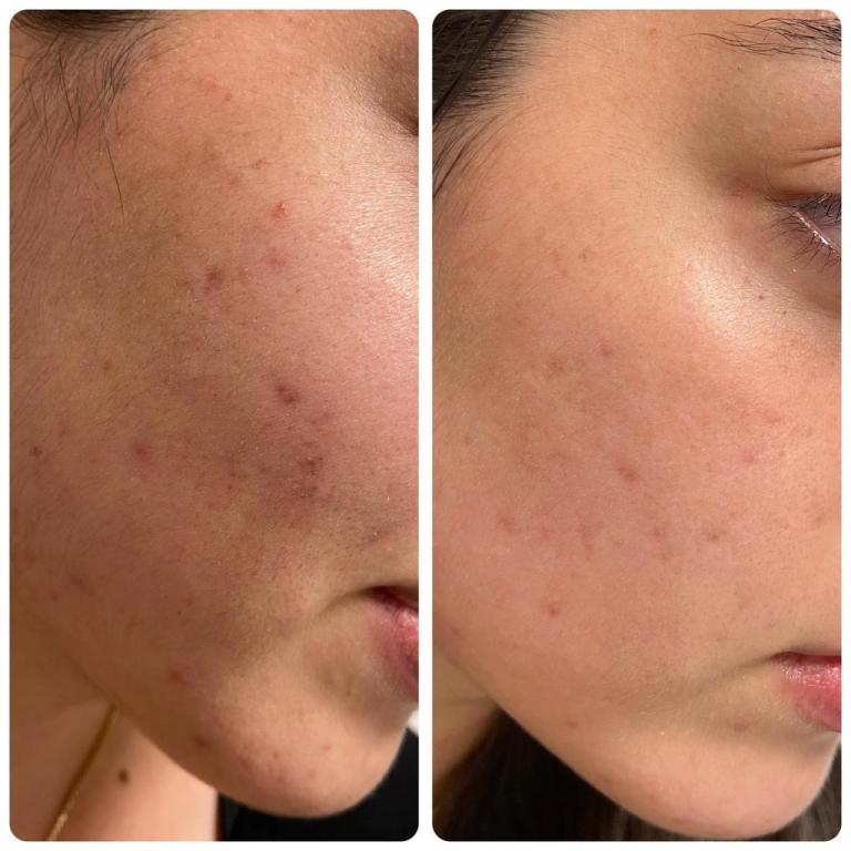 שלומית שטרקמן שלומית שטרקמן