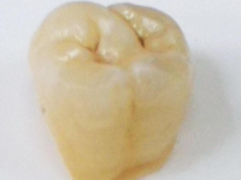 יעקובוב מעבדת שיניים יעקובוב מעבדת שיניים