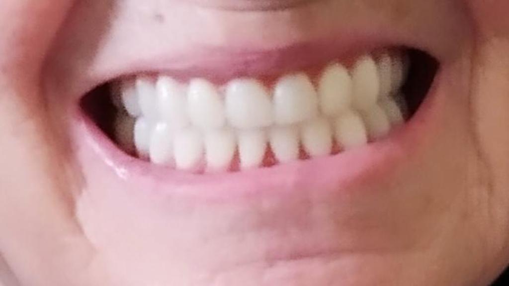 יעקובוב מעבדת שיניים יעקובוב מעבדת שיניים