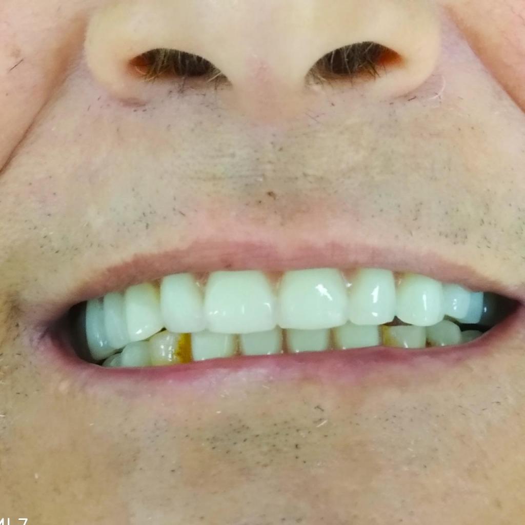 יעקובוב מעבדת שיניים יעקובוב מעבדת שיניים