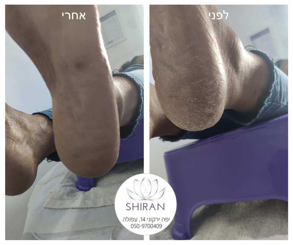 שירן נייל ארט שירן נייל ארט