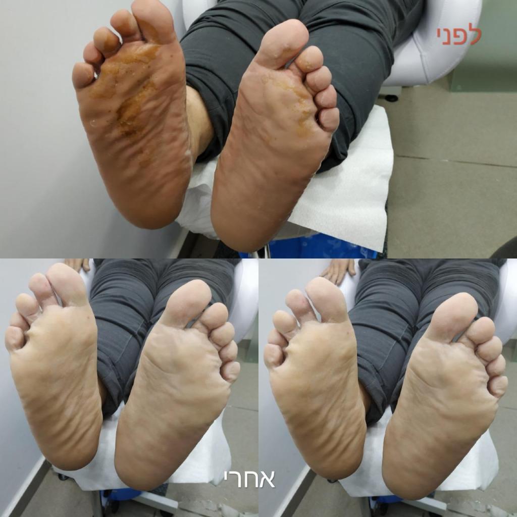 ציפורני הקסם ציפורני הקסם